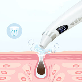 Electric Blackhead Suction Instrument - Pore Cleaner Tool USA Online